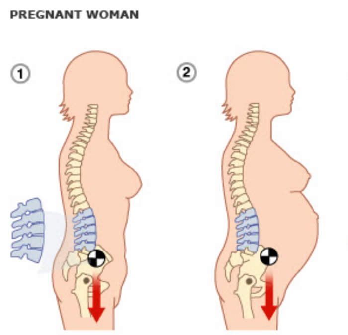 Спина после беременности