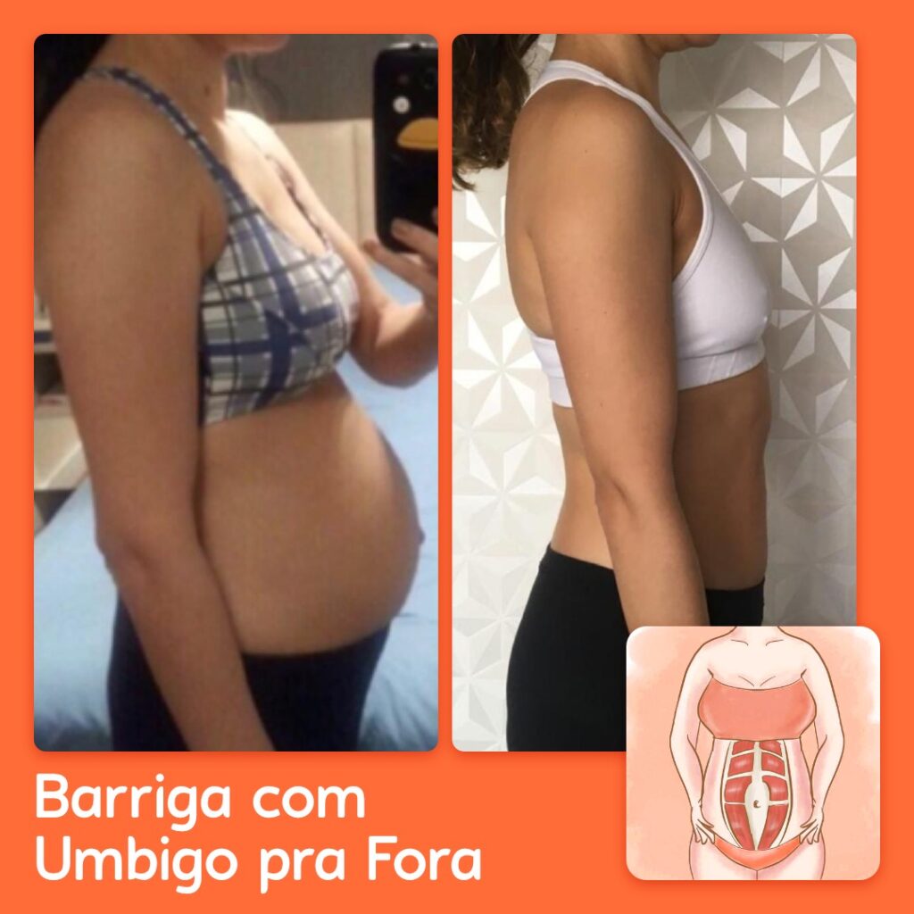 exercícios para diástase