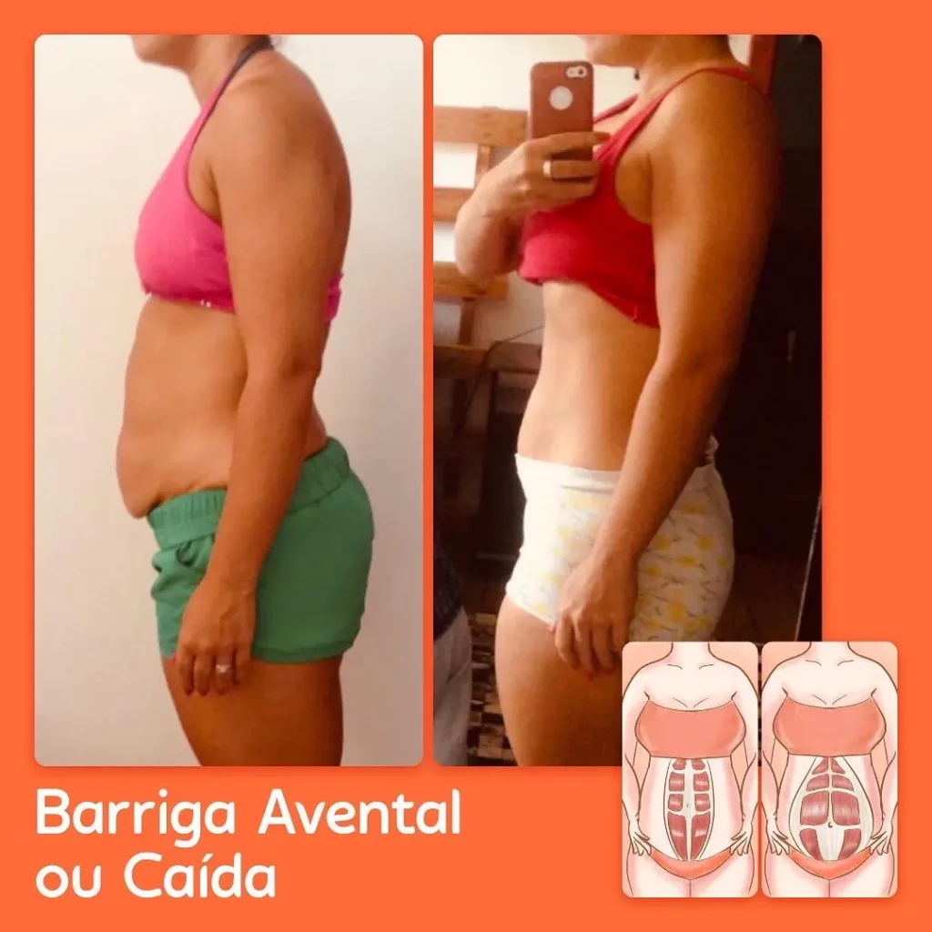 barriga avental