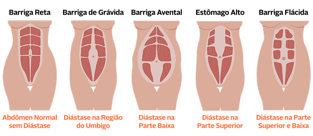 Nova SOS Barriga Gizele Monteiro