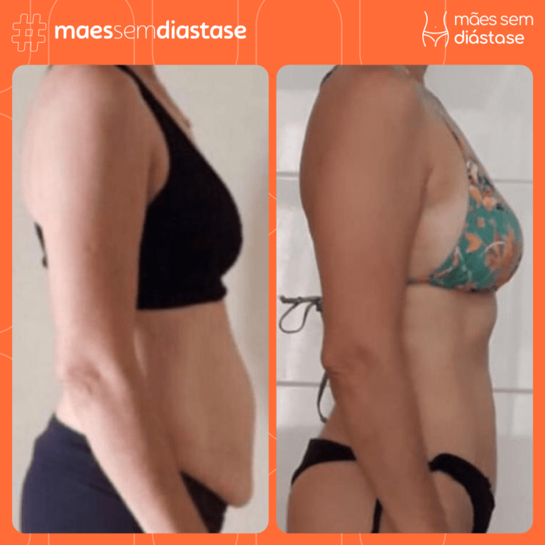 BARRIGA AVENTAL TEM SOLUÇÃO