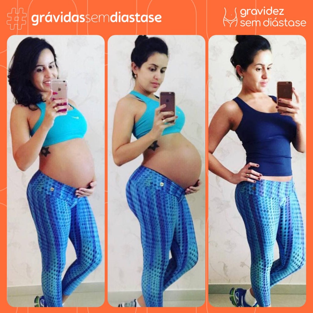 gravidez sem diástase