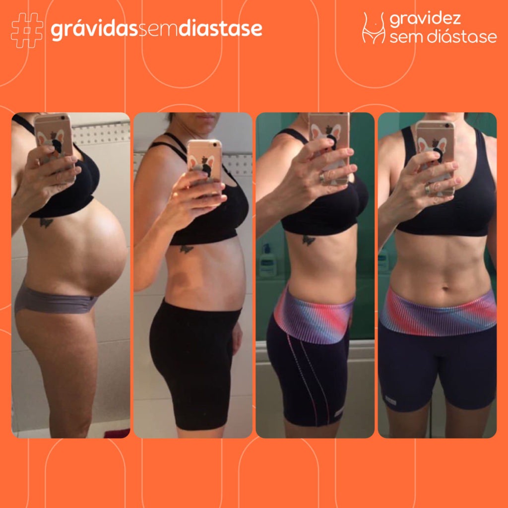 gravidez sem diástase
