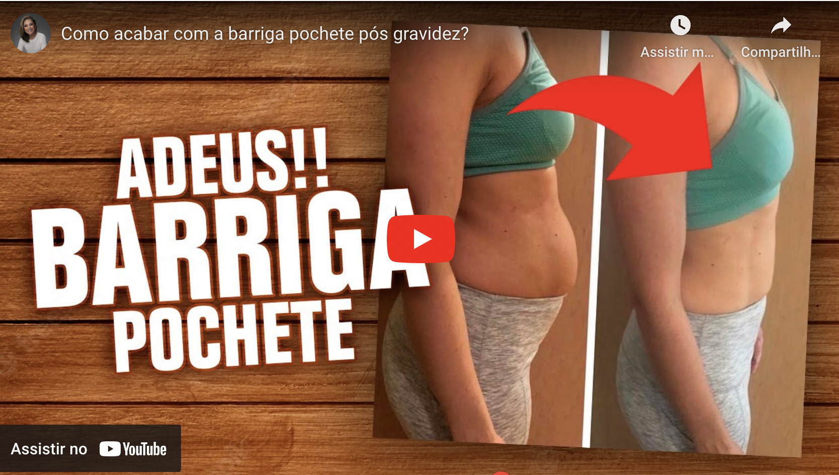 como acabar com a barriga pochete