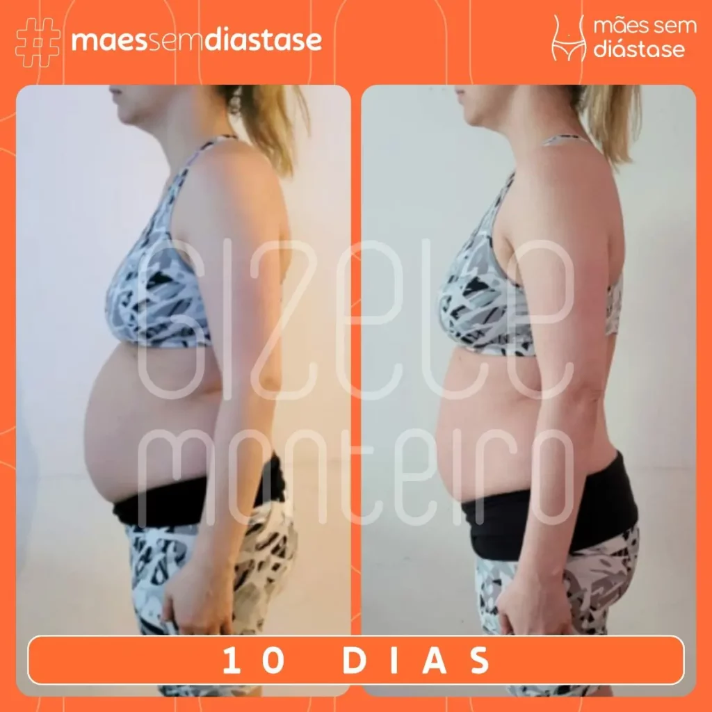 Programa Mães Sem Diástase
