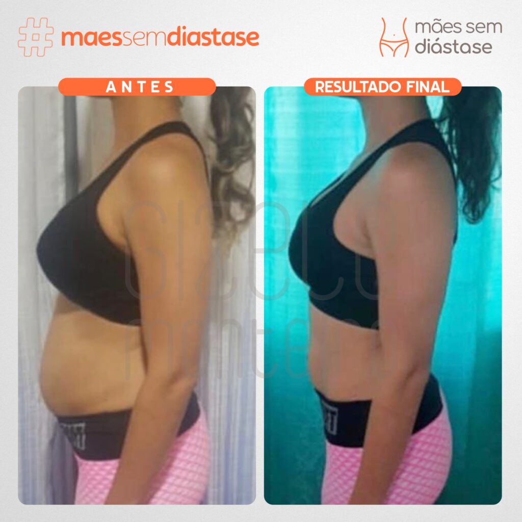 exercícios poderosos para diástase
