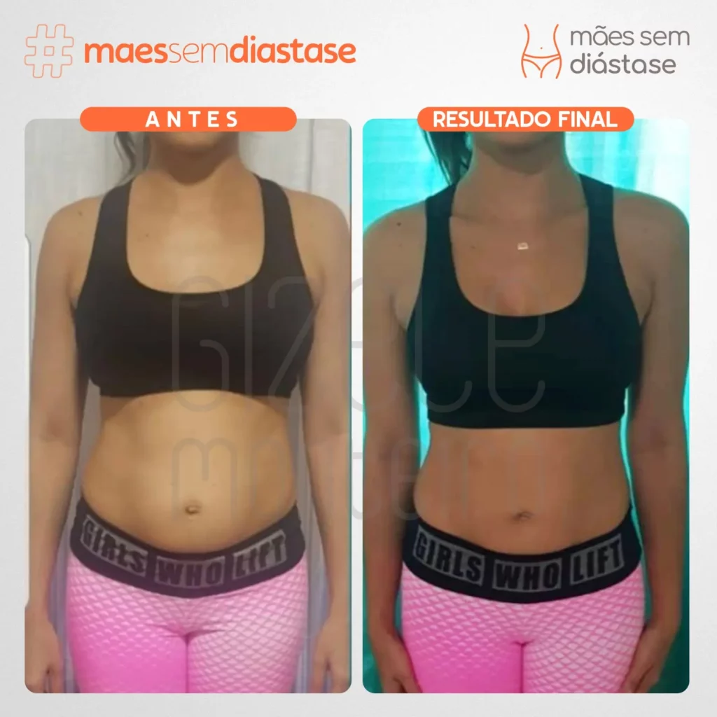 como saber se tenho diástase