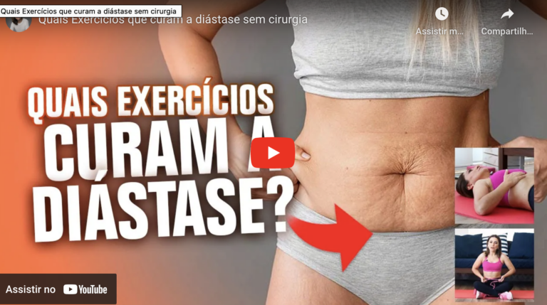 Exercícios para Reduzir a Diástase