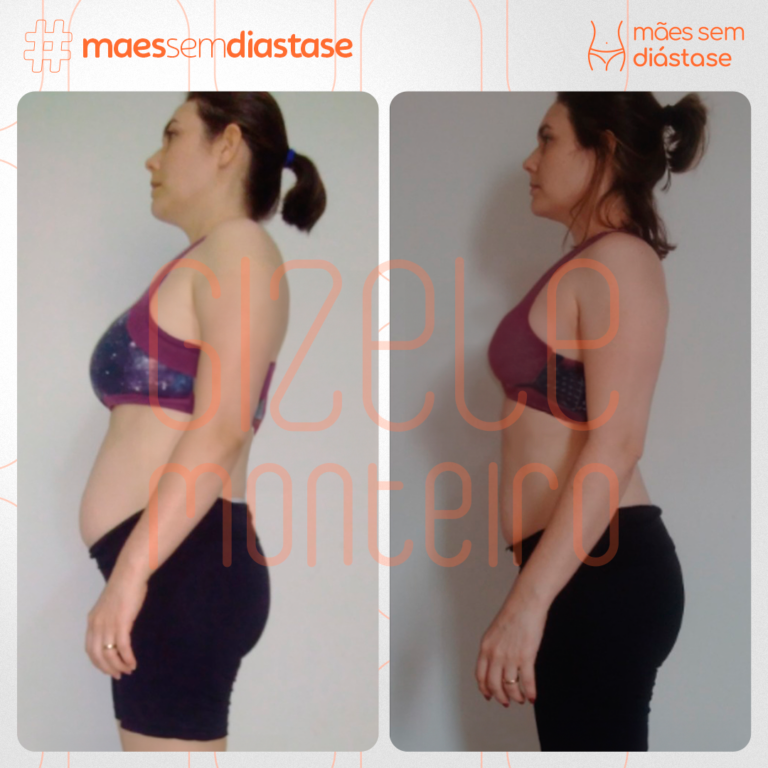 Como desinchar e ter a barriga dos sonhos após a gravidez