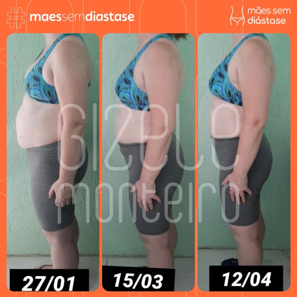 acabar com a barriga de grávida sem cirurgia