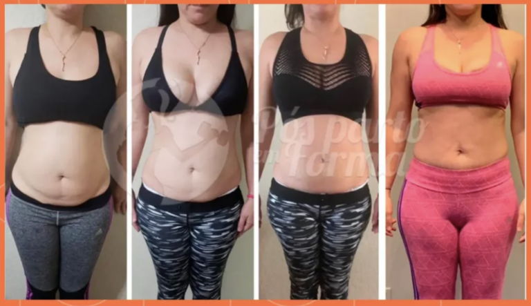 Melhora da Pele Flácida da Barriga Sem Cirurgia