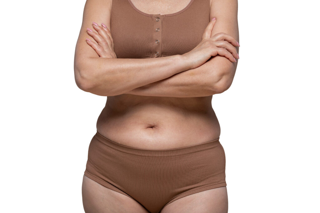 a barriga após o parto