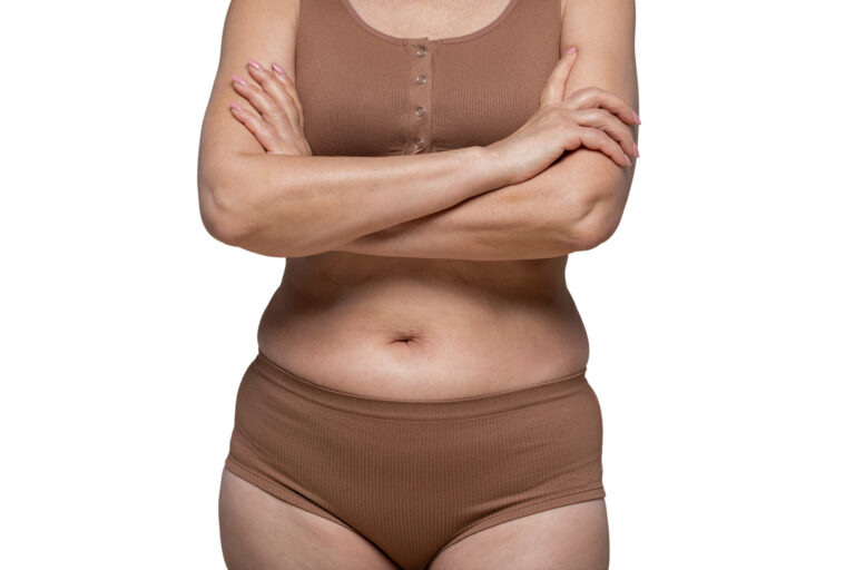 a barriga após o parto