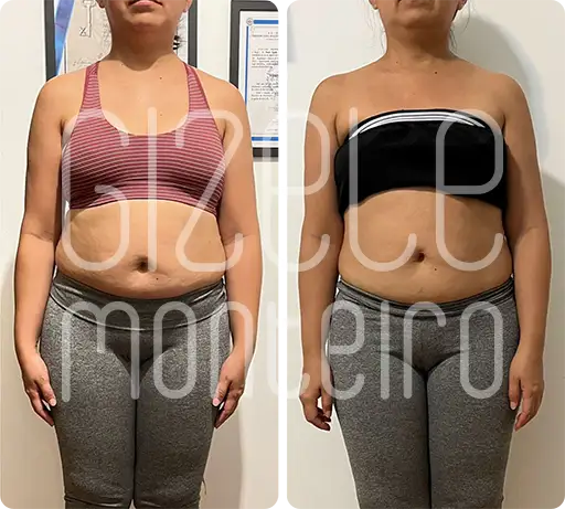 sos barriga