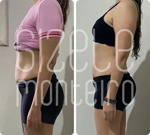 SOS BARRIGA