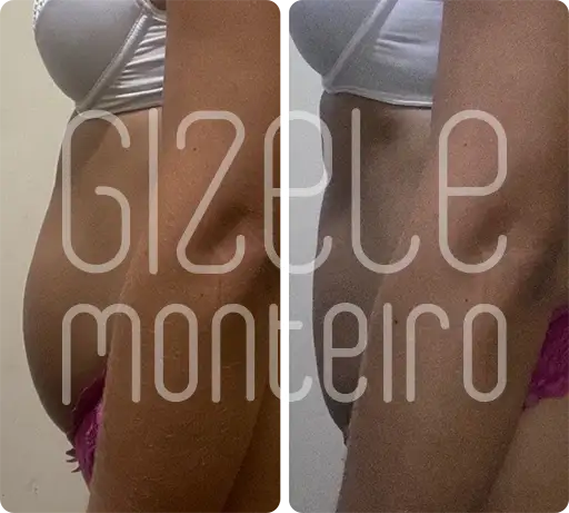 SOS BARRIGA
