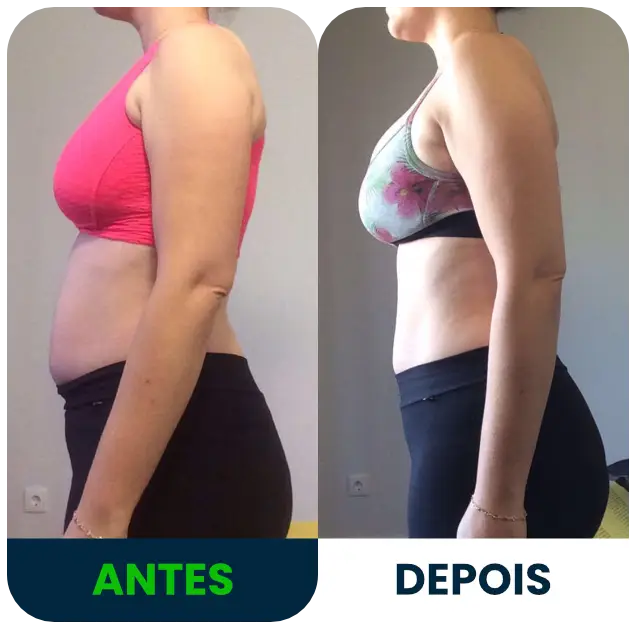 diástase
