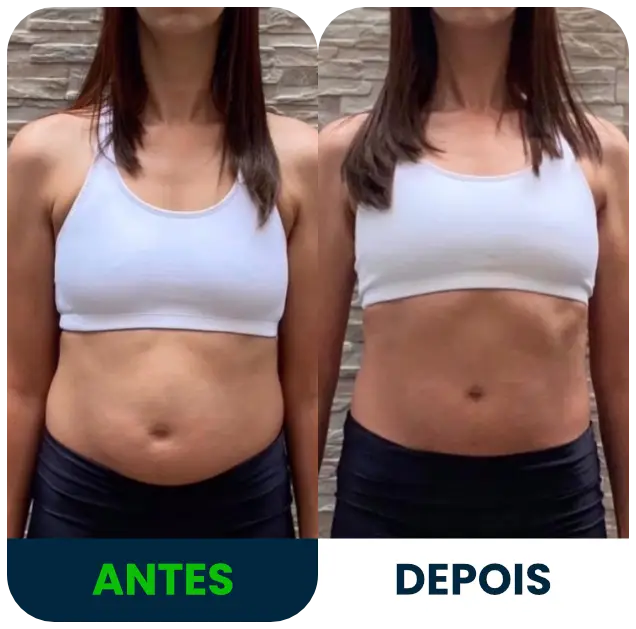 diástase