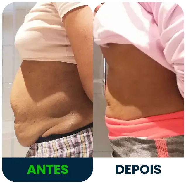 diástase