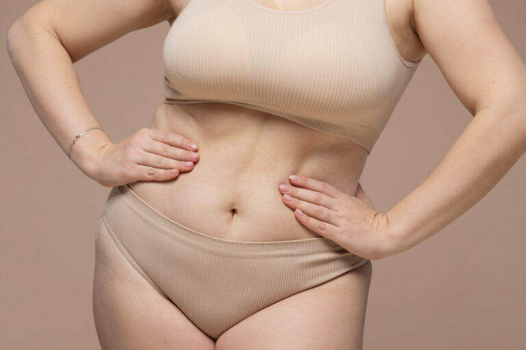 flacidez abdominal pós-gravidez