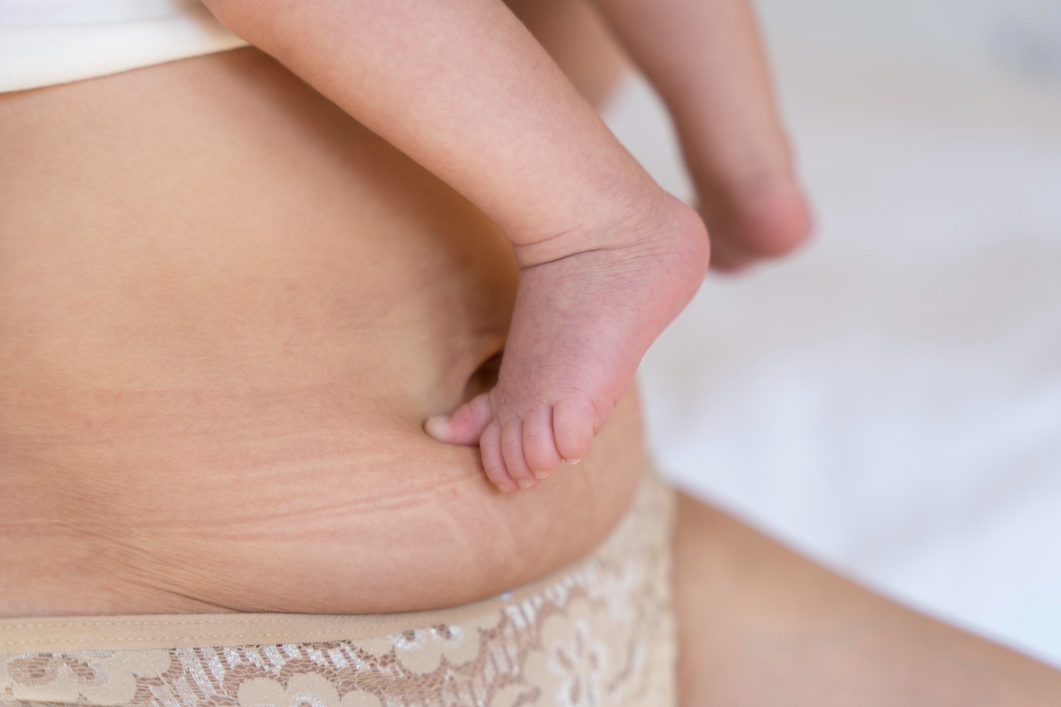 barriga pós-parto