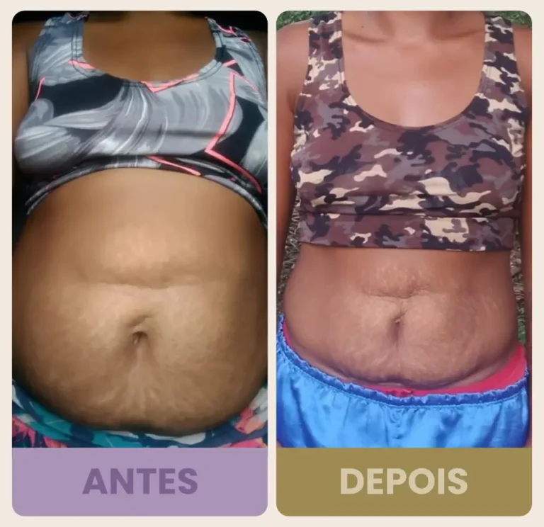 antes e depois