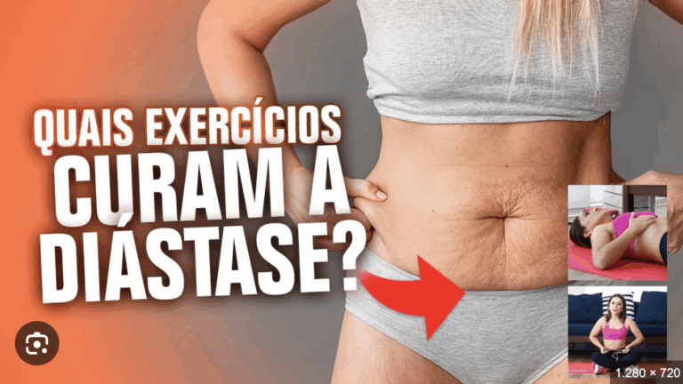 como tratar diastase com exercicios