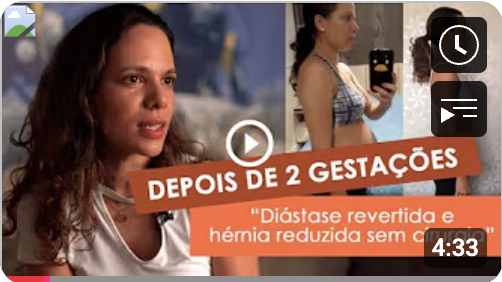 diástase sem cirurgia