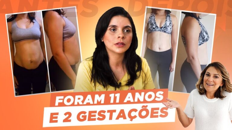 Após 11 anos, ela recuperou a diástase cirúrgica e a barriga avental sem cirurgia. Descubra como venceu a dor e reconquistou sua autoestima.