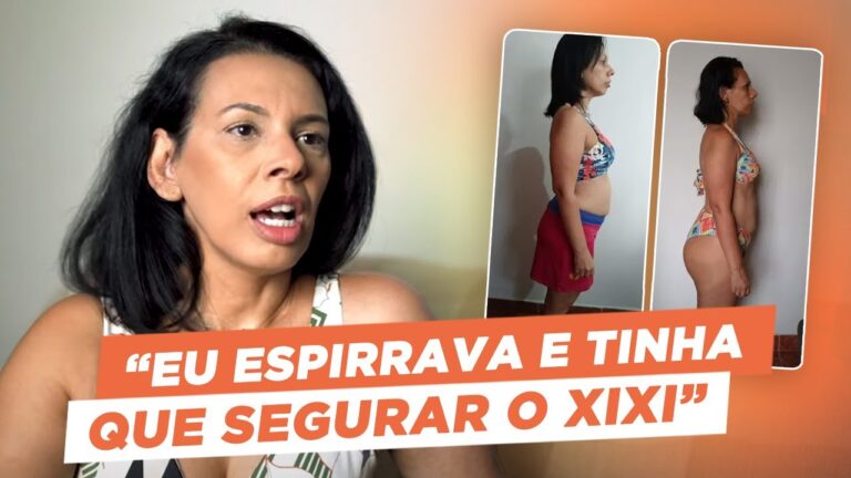 vencer a diástase sem cirurgia