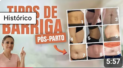 tipos de barriga após a gravidez