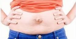 diástase abdominal