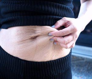 Por que a barriga fica flácida depois da gravidez