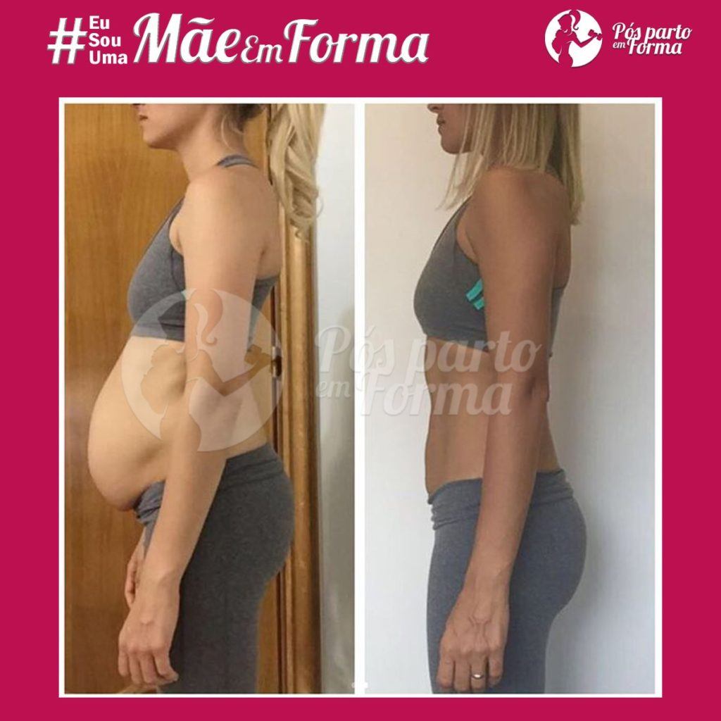 Como reverter a barriga avental sem cirurgia